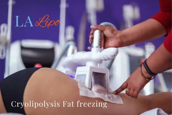 women getting fat freezing Dormer's Wells