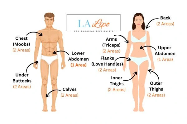 LA LIPO Cryolipolysis Areas Dormer's Wells
