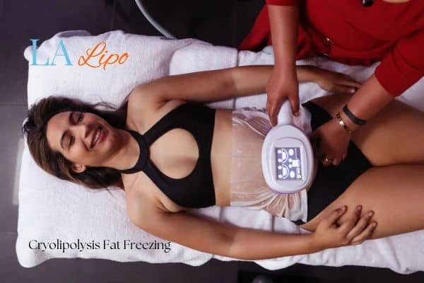 woman getting cryolipolysis Dormer's Wells