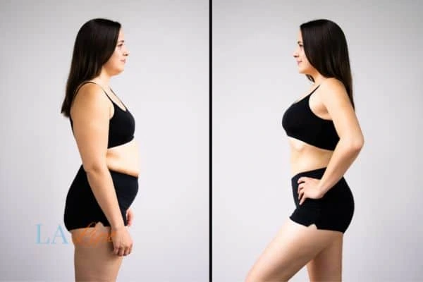 Picture of womans before and after using LA-EMS body sculpting to improve her core strength Dormer's Wells