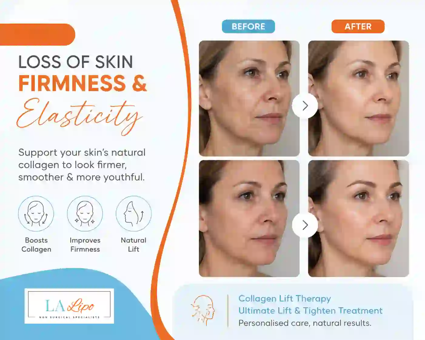 Sign #7: Loss of Skin Firmness and Elasticity Dormer's Wells